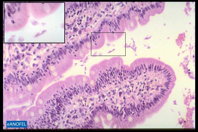 P022