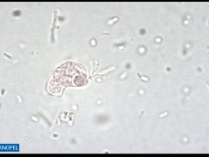 P023