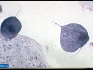 P025