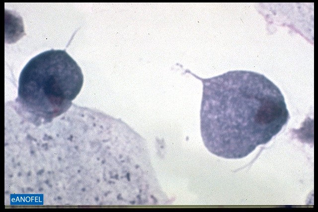 P025