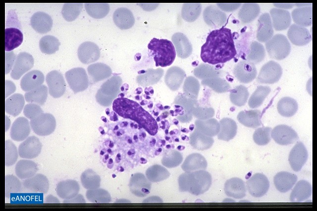 P026