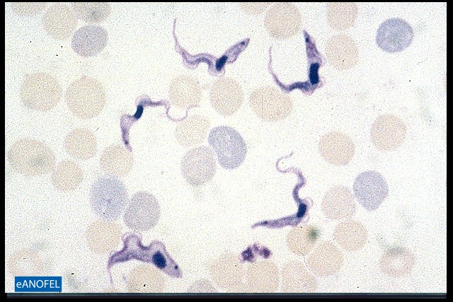 P036