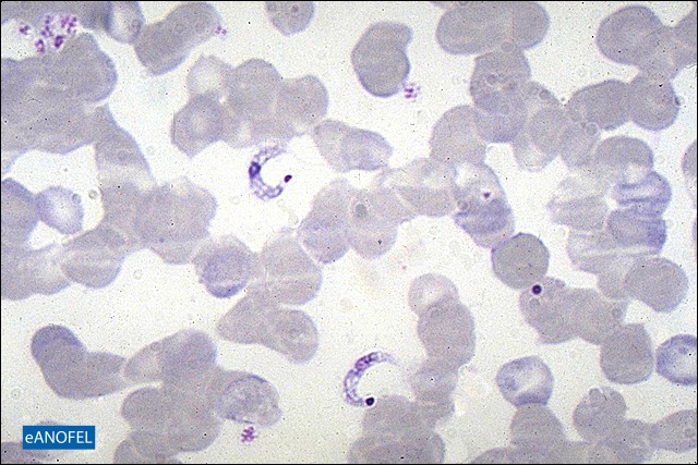 P038