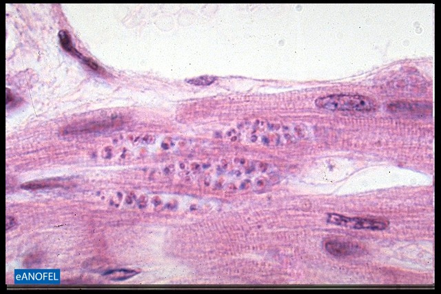 P039