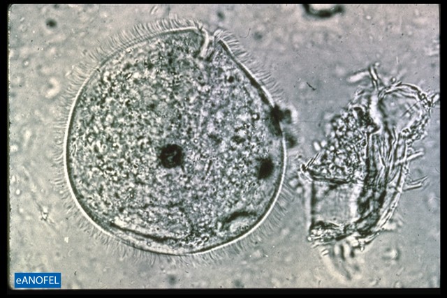 P041