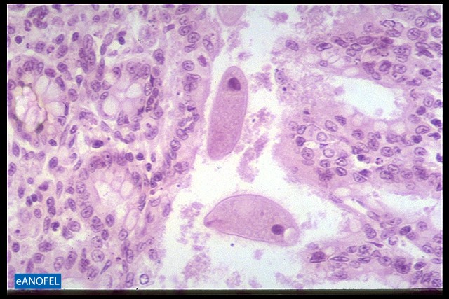 P043