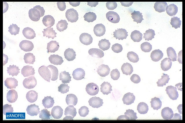 P044