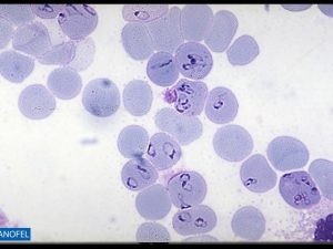P045