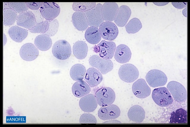 P045