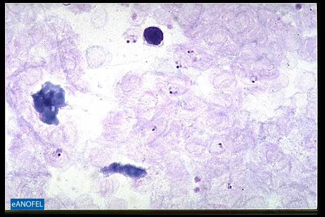P046