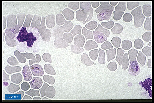 P048