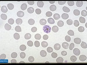 P049