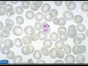 P050