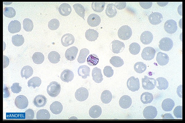 P052