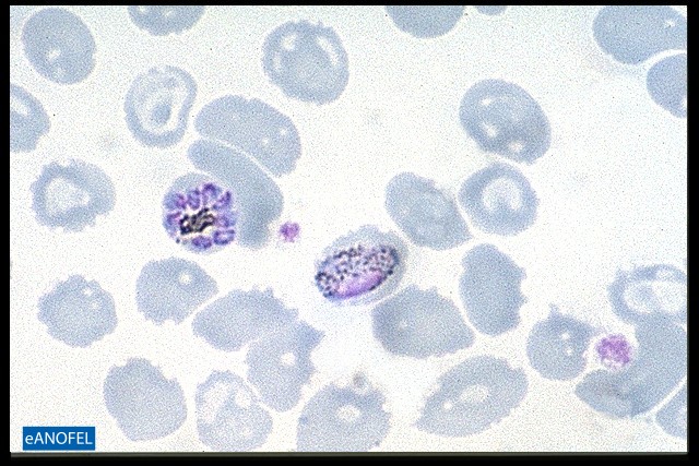 P053