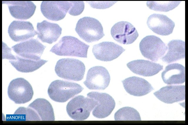 P062