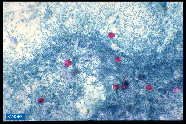 P063