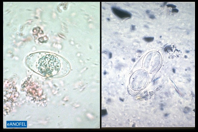 P066