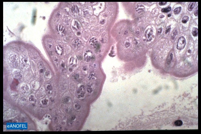 P067