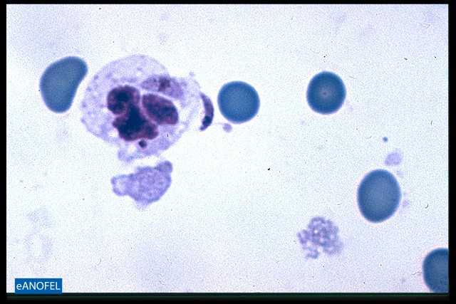 P071