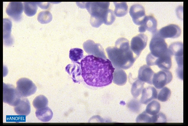 P072