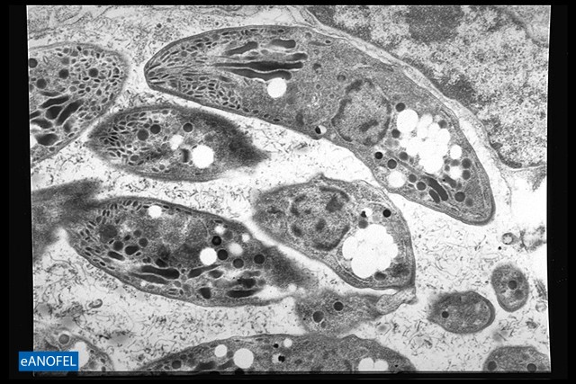 P076