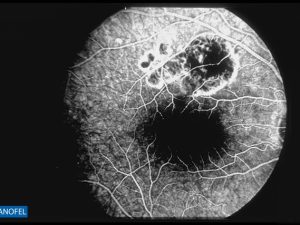 P079
