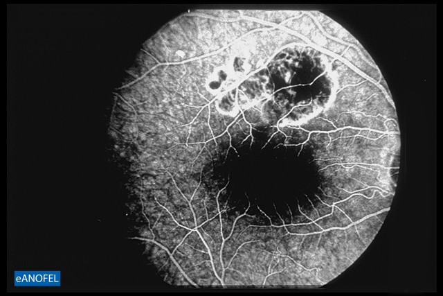 P079