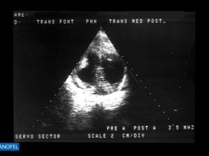 P081