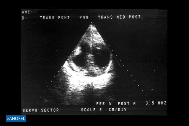 P081
