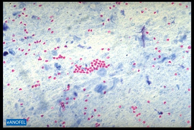 P086