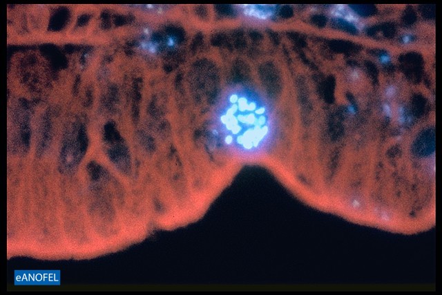 P087