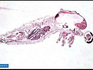 P091