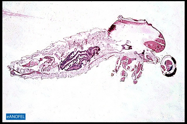 P091