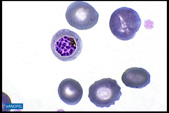 P093