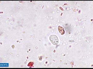 P123