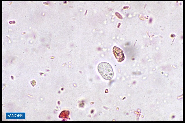 P123