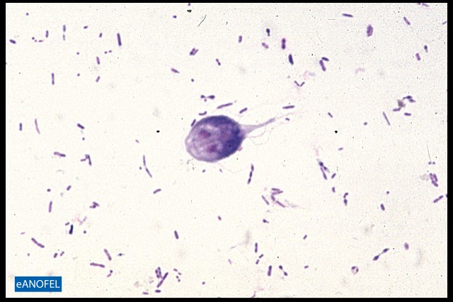 P128