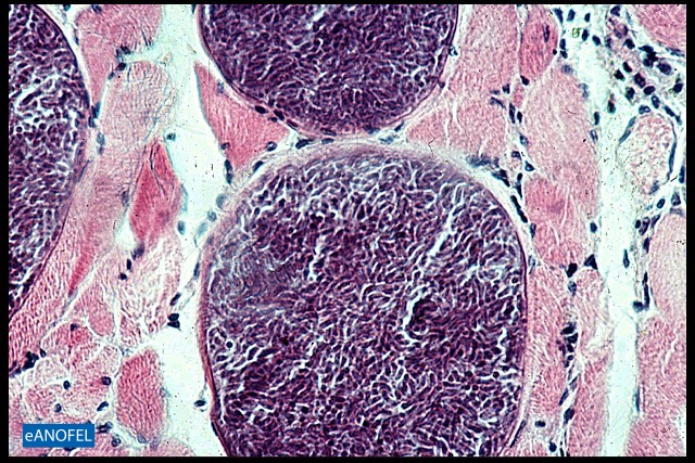 P153