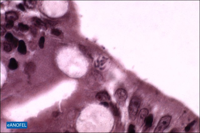 P241