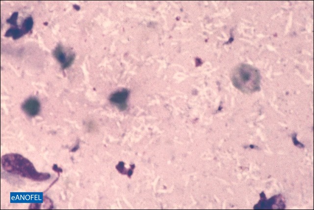 P246
