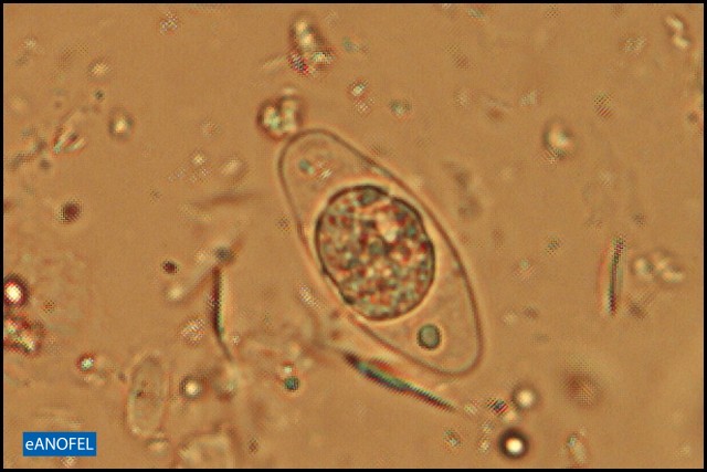 P461