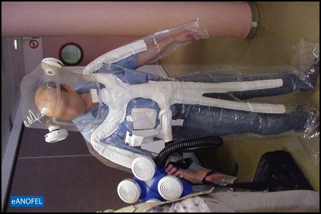 R151